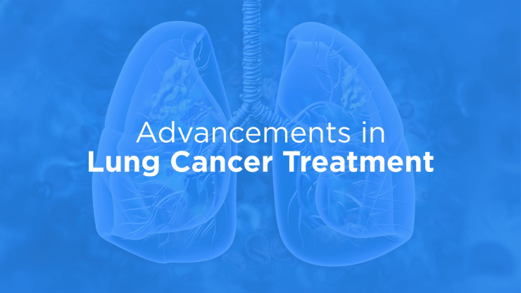 Advancements in Lung Cancer Treatment