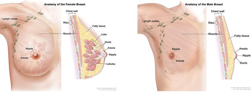 Understanding Swollen Lymph Nodes in Breast Cancer